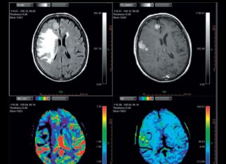 What is Medical Image Processing? images