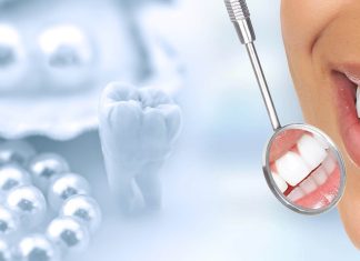 Restoring Health and Confidence with Gum Grafting at Misch Implant & Aesthetic Dentistry