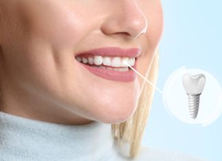 Get a Brighter Smile with Teeth Whitening in Vancouver