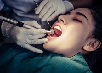 Dental Implants in Grand Rapids, MI: A Permanent Solution for Missing Teeth dental implants in Grand Rapids, MI