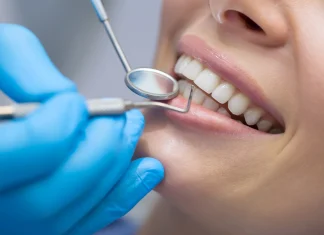 Dental Implants in North York: A Permanent Solution for Your Smile